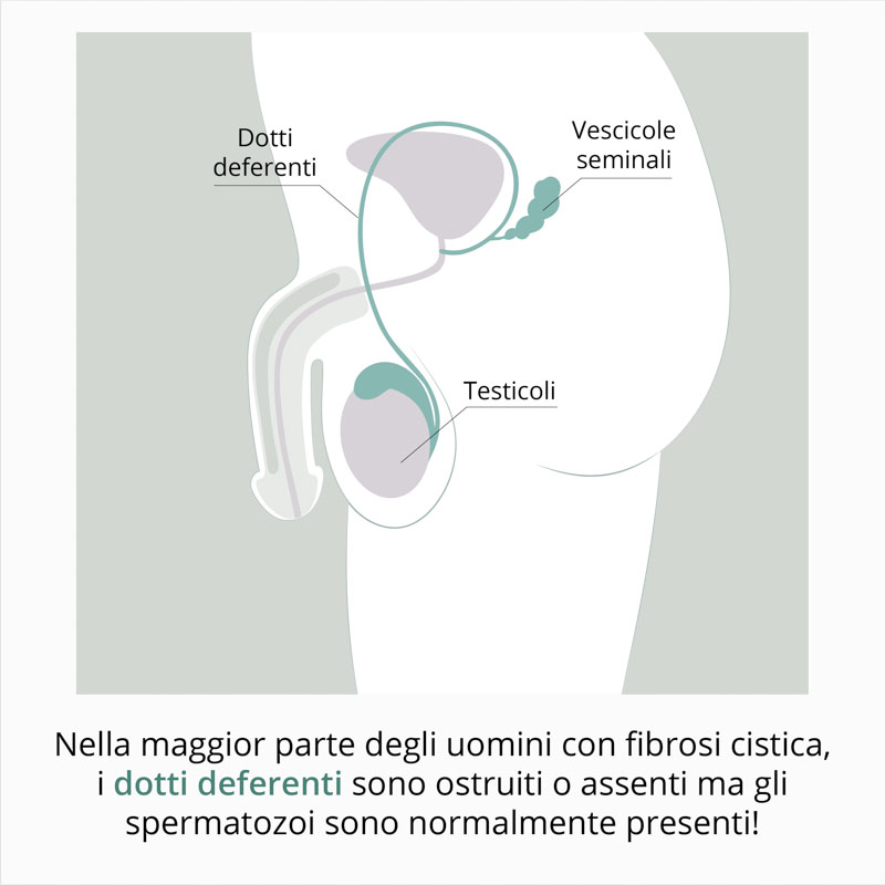 fibrosi cistica infertilità